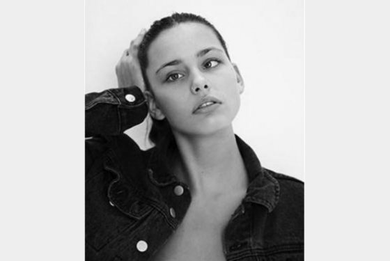 H Moffy Modelo κατάφερε και έγινε κορυφαίο μοντέλο παρά τον στραβισμό της [εικόνες]     | iefimerida.gr 4