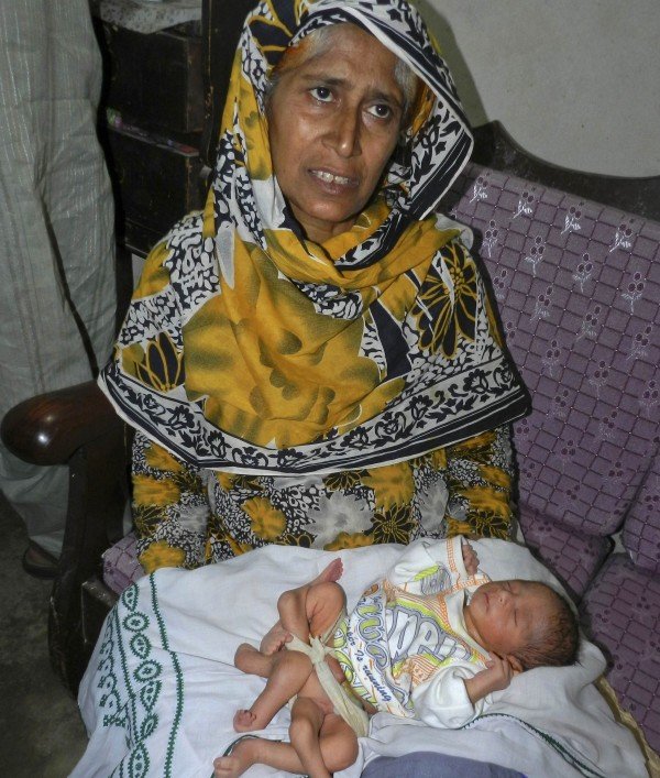 Παντρεύτηκε τον ξάδελφο της και γέννησε μωρό με έξι πόδια [εικόνες] | iefimerida.gr 1