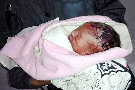 Εικόνες-σοκ: Πέταξε το μωρό της στα σκουπίδια – Το έτρωγαν τα μυρμήγκια ζωντανό [εικόνες] | iefimerida.gr 0