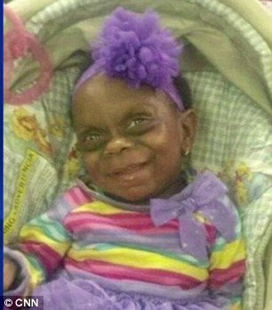 Η άσχημη πλευρά των social media: «Τρόλαραν» μωρό που πάσχει από σπάνια ασθένεια [εικόνες] | iefimerida.gr 0