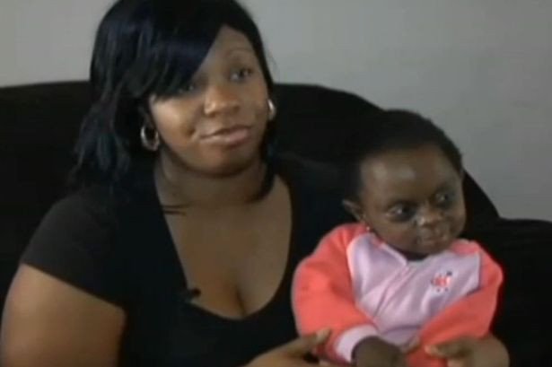 Η άσχημη πλευρά των social media: «Τρόλαραν» μωρό που πάσχει από σπάνια ασθένεια [εικόνες] | iefimerida.gr 3