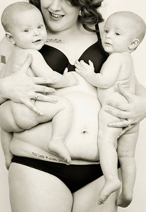 Ιδού πώς αλλάζει η μητρότητα το σώμα μιας γυναίκας -Η απάτη των μη ρεαλιστικών προτύπων  [εικόνες&βίντεο] | iefimerida.gr 2