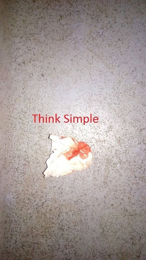 Πέταξαν γυάλινο μπουκάλι σε λεωφορείο του ΟΑΣΘ -Τραυματίστηκε μία γυναίκα [εικόνες] | iefimerida.gr 2