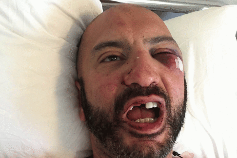 Ζευγάρι ομοφυλοφίλων ξυλοκοπήθηκε μέχρι αναισθησίας στη Μύκονο [εικόνες] | iefimerida.gr 2