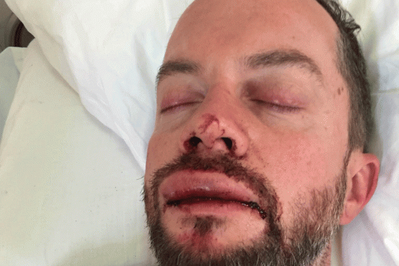 Ζευγάρι ομοφυλοφίλων ξυλοκοπήθηκε μέχρι αναισθησίας στη Μύκονο [εικόνες] | iefimerida.gr 3