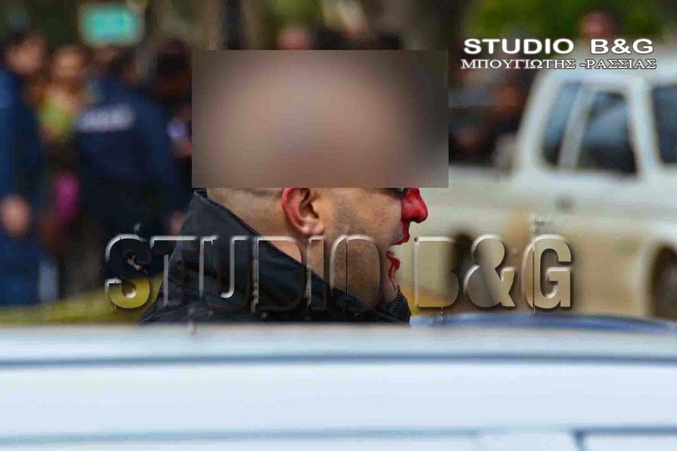 Ρομά έσπασαν στο ξύλο αστυνομικούς επειδή δεν τους άρεσε η δικαστική απόφαση [εικόνες & βίντεο] | iefimerida.gr 5