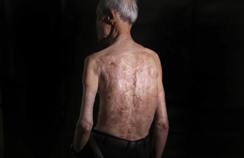 Πέθανε ο Σουμιτέρου Τανιγκούτσι, επιζών της ατομικής βόμβας στο Ναγκασάκι -Πώς περιέγραφε τη στιγμή της έκρηξης [εικόνες] | iefimerida.gr 1