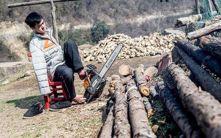 Ο 27χρονος που γεννήθηκε χωρίς χέρια και έγινε πετυχημένος online επιχειρηματίας [εικόνες]  | iefimerida.gr 2