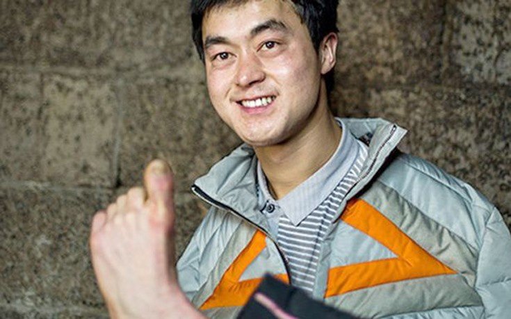 Ο 27χρονος που γεννήθηκε χωρίς χέρια και έγινε πετυχημένος online επιχειρηματίας [εικόνες]  | iefimerida.gr 3