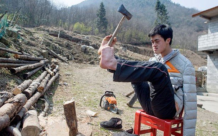 Ο 27χρονος που γεννήθηκε χωρίς χέρια και έγινε πετυχημένος online επιχειρηματίας [εικόνες]  | iefimerida.gr 4