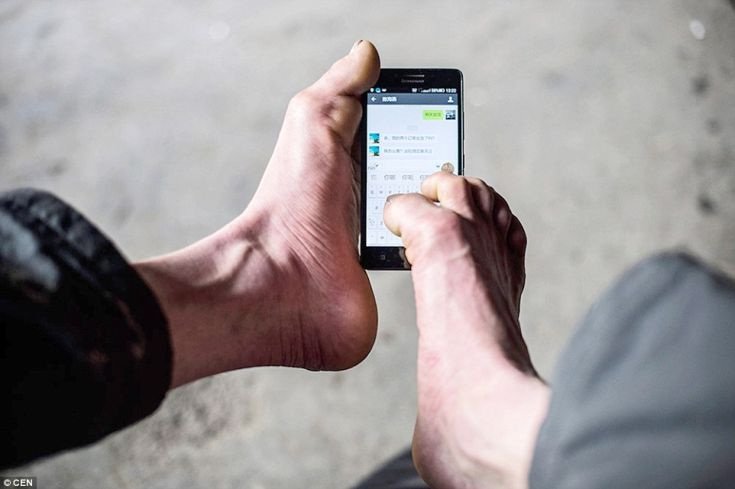 Ο 27χρονος που γεννήθηκε χωρίς χέρια και έγινε πετυχημένος online επιχειρηματίας [εικόνες]  | iefimerida.gr 5