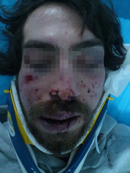 Σοκαριστικός ξυλοδαρμός φοιτητή από κουκουλοφόρους στην Αθήνα - Kαταγγελίες ότι ήταν τάγμα χρυσαυγιτών [σκληρές εικόνες] | iefimerida.gr 0