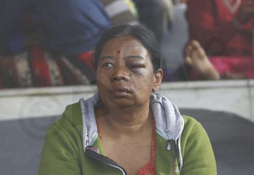 Εικόνες Αποκάλυψης στο Νεπάλ: Ξεπερνούν τους 3.200 οι νεκροί από τον σεισμό [εικόνες] | iefimerida.gr 17