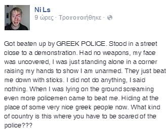 Γερμανός φοιτητής καταγγέλλει: Με χτύπησαν τα ΜΑΤ -Δεν ήμουν καν στην πορεία [εικόνες] | iefimerida.gr 1