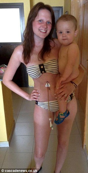 Η 25χρονη που δεν έχει φάει τίποτα τα 7 τελευταία χρόνια -Μια περίεργη ασθένεια [εικόνες] | iefimerida.gr 2