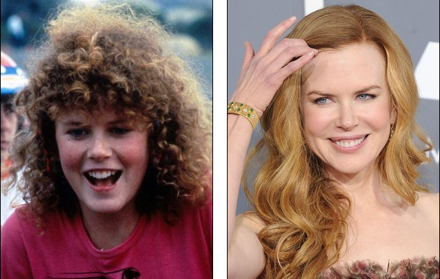 Τα ασχημόπαπα που έγιναν διάσημοι κύκνοι [εικόνες] | iefimerida.gr 3