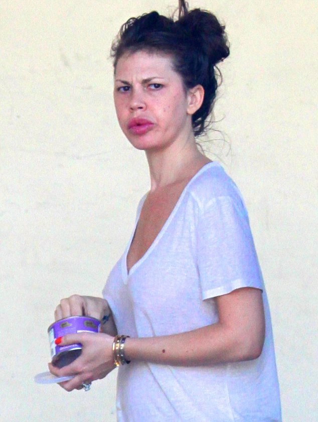 Γελάνε μαζί της - Η τηλεοπτική σταρ που κατέληξε με χείλη ροφού [εικόνες]  | iefimerida.gr 1