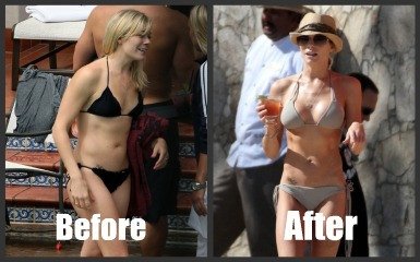 Τεράστιο στήθος για μια βραδιά -Η νέα τρέλα της Αμερικής [εικόνες] | iefimerida.gr 2