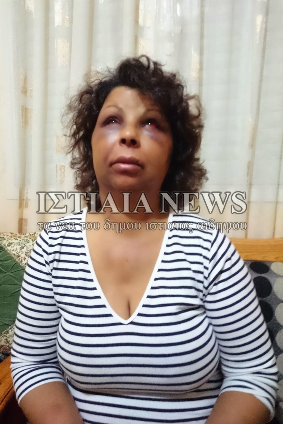 Σκηνικό απίστευτης βιαιότητας στην Εύβοια: Παρέα ανδρών βασάνισε οικιακή βοηθό [εικόνες] | iefimerida.gr 1