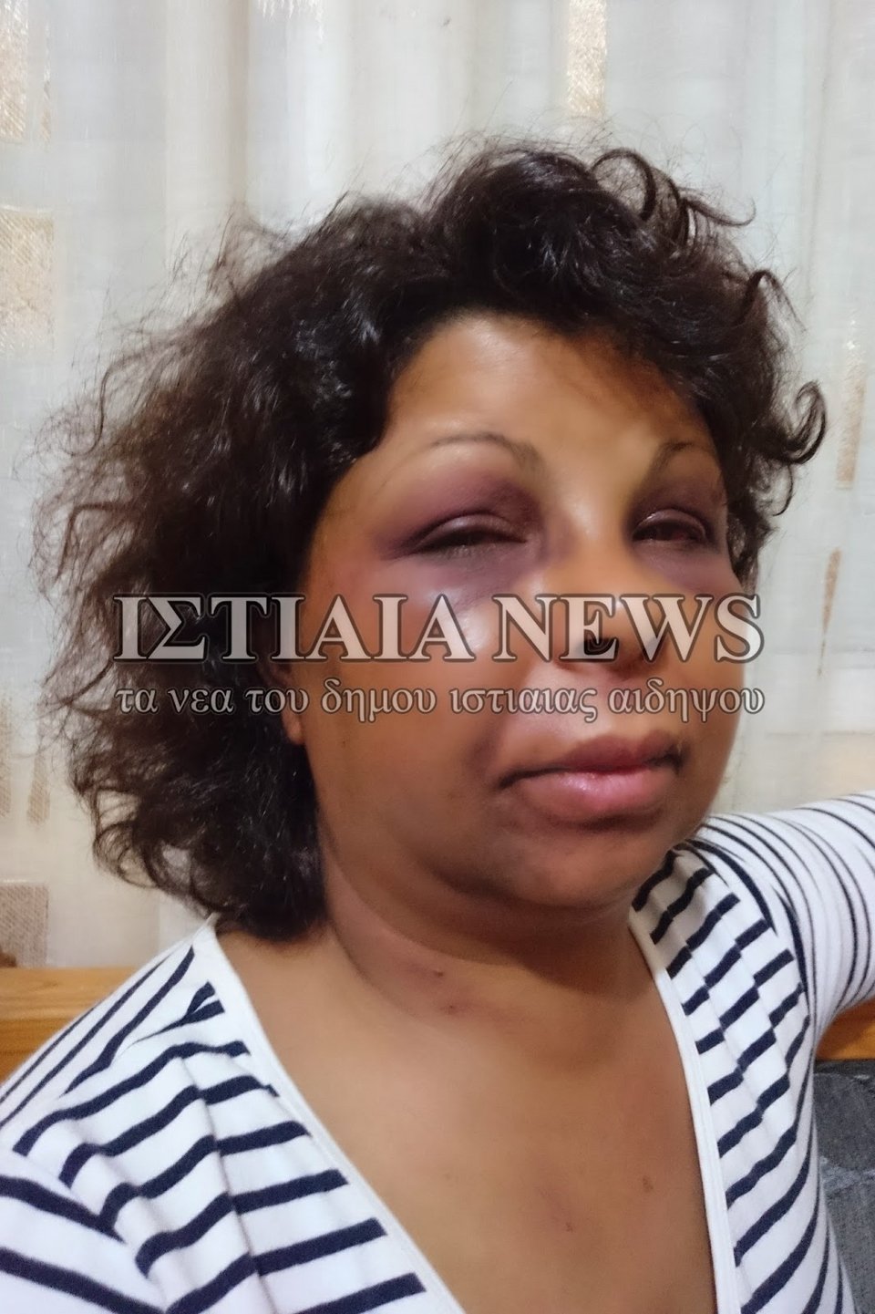 Σκηνικό απίστευτης βιαιότητας στην Εύβοια: Παρέα ανδρών βασάνισε οικιακή βοηθό [εικόνες] | iefimerida.gr 2