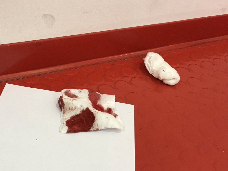 Καταγγελίες Ολυμπιακού για ξυλοδαρμό μετά το ματς με την ΑΕΚ [εικόνες] | iefimerida.gr 1