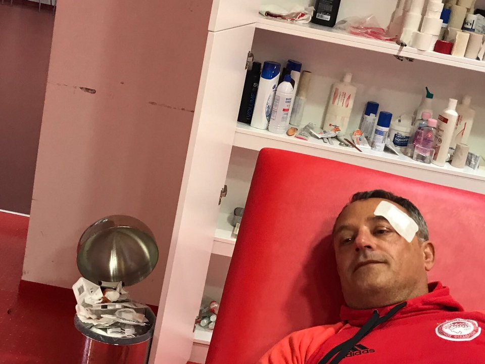 Καταγγελίες Ολυμπιακού για ξυλοδαρμό μετά το ματς με την ΑΕΚ [εικόνες] | iefimerida.gr 0