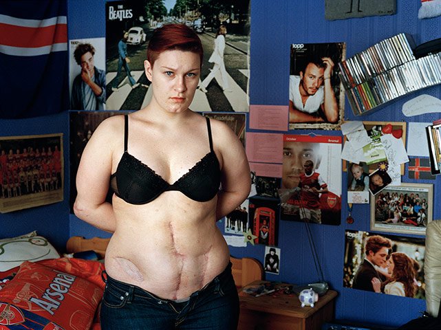 Τα συγκλονιστικά πορτραίτα των νέων που γλίτωσαν από τη φονική μανία του Μπρέιβικ βραβεύθηκαν σε διαγωνισμό [εικόνες] | iefimerida.gr 6