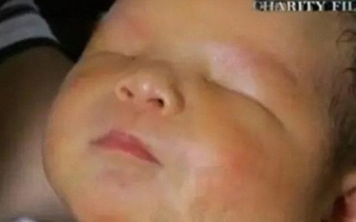 Συγκλονιστικό: Βρέφος στην Κίνα γεννήθηκε χωρίς μάτια [εικόνες & βίντεο] | iefimerida.gr 0