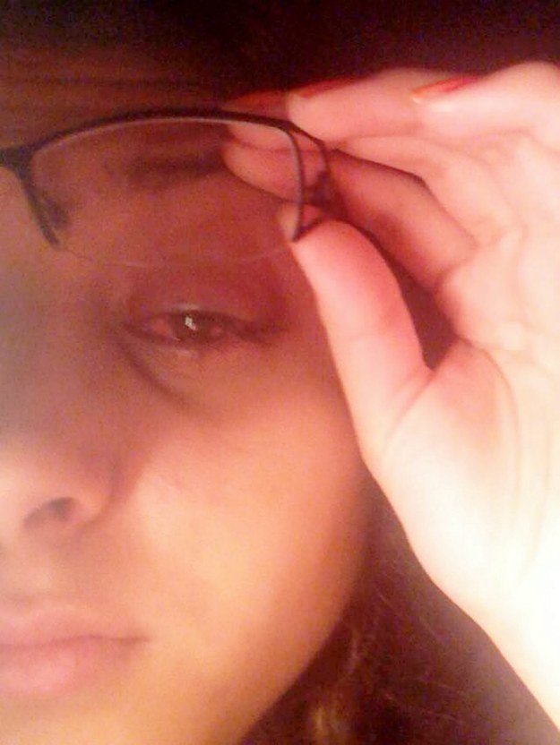 Εμεινε ξύπνια μια εβδομάδα για να εξοντώσει ένα παράσιτο που της έτρωγε το μάτι [εικόνες] | iefimerida.gr 1