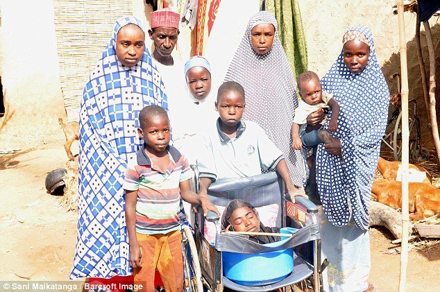 Νιγηρία: Η 19χρονη που ζει σε μία πλαστική λεκάνη -Πάσχει από άγνωστη ασθένεια [εικόνες & βίντεο] | iefimerida.gr 0