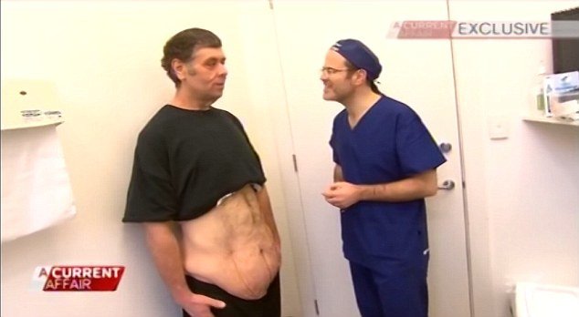 Απίστευτη μεταμόρφωση: Υπέρβαρος ομογενής στην Αυστραλία έχασε 203 κιλά [εικόνες & βίντεο] | iefimerida.gr 4