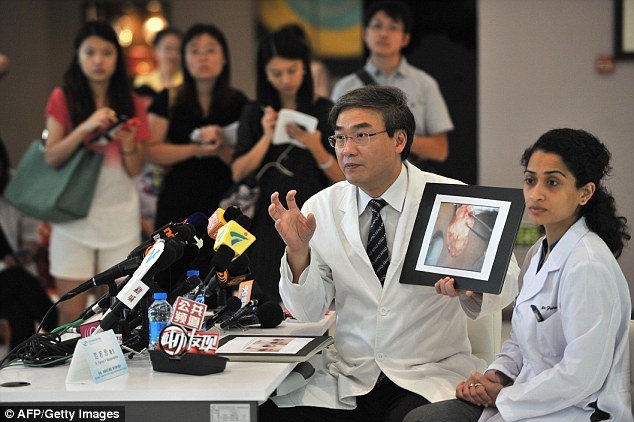 Η τρομερή ιστορία του 6χρονου αγοριού με τα γυάλινα μάτια -Σήμερα χορεύει, χαμογελά και ελπίζει [εικόνες&βίντεο] | iefimerida.gr 2