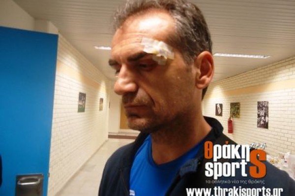 Φωτογραφίες- Σοκ του τραυματισμένου γενικού αρχηγού του Πανθρακικού [εικόνες] | iefimerida.gr 1