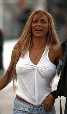 Ποια γνωστή τραγουδίστρια άλλαξε τα πάντα εκτός από το στήθος της; [εικόνες] | iefimerida.gr 1