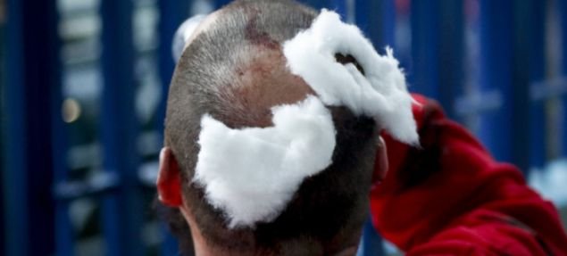 Αλωνίζουν οι κουκουλοφόροι σε Αθήνα-Θεσσαλονίκη: Επιθέσεις σε Α.Τ. και ΜΑΤ [εικόνες & βίντεο] | iefimerida.gr 5