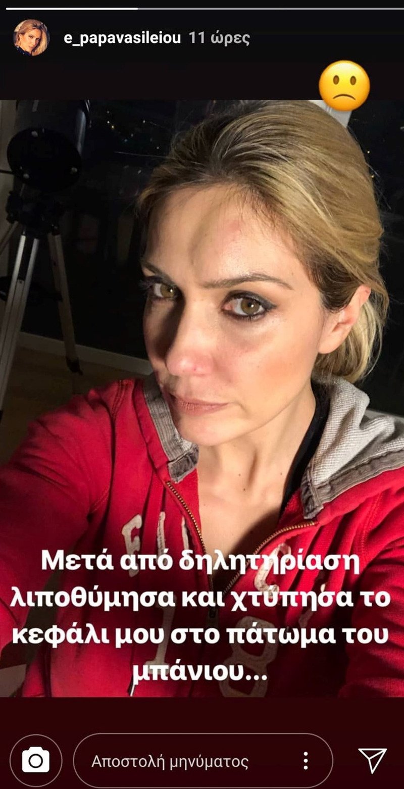 Το τεράστιο καρούμπαλο της Έλενας Παπαβασιλείου μετά το ατύχημά της