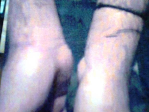 Μηνύει αστυνομικούς για ξυλοδαρμό -«Με βασάνιζαν επί μιάμιση ώρα και με χτυπούσαν σε όλο το σώμα» [εικόνες] | iefimerida.gr 1