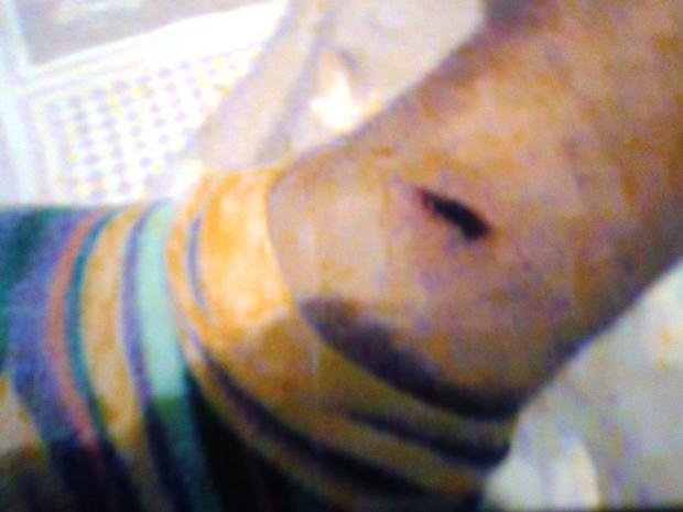 Μηνύει αστυνομικούς για ξυλοδαρμό -«Με βασάνιζαν επί μιάμιση ώρα και με χτυπούσαν σε όλο το σώμα» [εικόνες] | iefimerida.gr 2