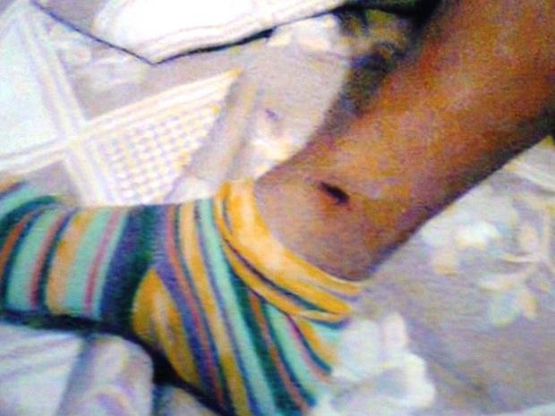 Μηνύει αστυνομικούς για ξυλοδαρμό -«Με βασάνιζαν επί μιάμιση ώρα και με χτυπούσαν σε όλο το σώμα» [εικόνες] | iefimerida.gr 3