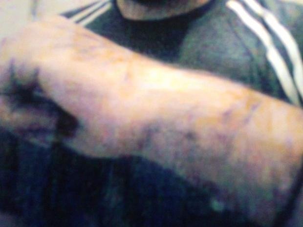 Μηνύει αστυνομικούς για ξυλοδαρμό -«Με βασάνιζαν επί μιάμιση ώρα και με χτυπούσαν σε όλο το σώμα» [εικόνες] | iefimerida.gr 0