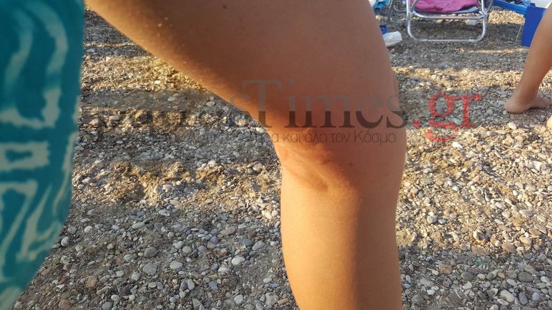 Δίχως τέλος το πρόβλημα με τις μέδουσες: Γέμισαν όλες οι πλαζ της Πάτρας, τις έβγαζαν με απόχες [εικόνες] | iefimerida.gr 0