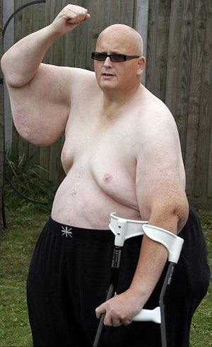 Κατάφερε να χάσει 190 κιλά μέσα σε δύο χρόνια [εικόνες-βιντεο] | iefimerida.gr 0