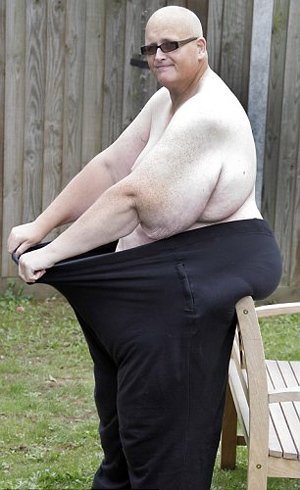 Κατάφερε να χάσει 190 κιλά μέσα σε δύο χρόνια [εικόνες-βιντεο] | iefimerida.gr 1