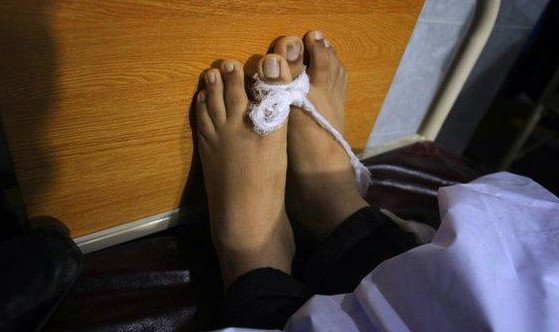 Παγκόσμιο σοκ: Πάνω από 140 νεκροί, οι περισσότεροι μαθητές, από την επίθεση των Ταλιμπάν σε σχολείο του Πακιστάν - Εικόνες φρίκης | iefimerida.gr 4