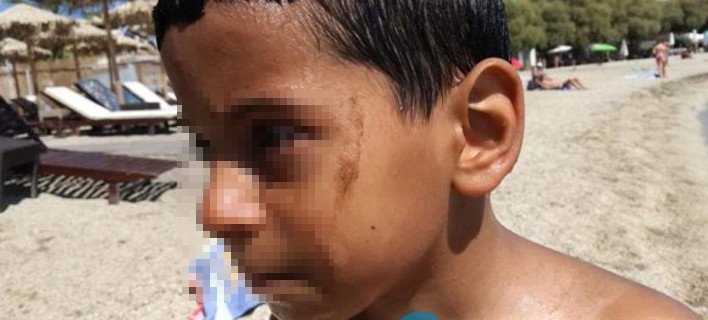 Αδιανόητο: Παιδιά κάνουν μπάνιο στον Αλιμο και βγαίνουν με πίσσες [εικόνες & βίντεο] | iefimerida.gr 0