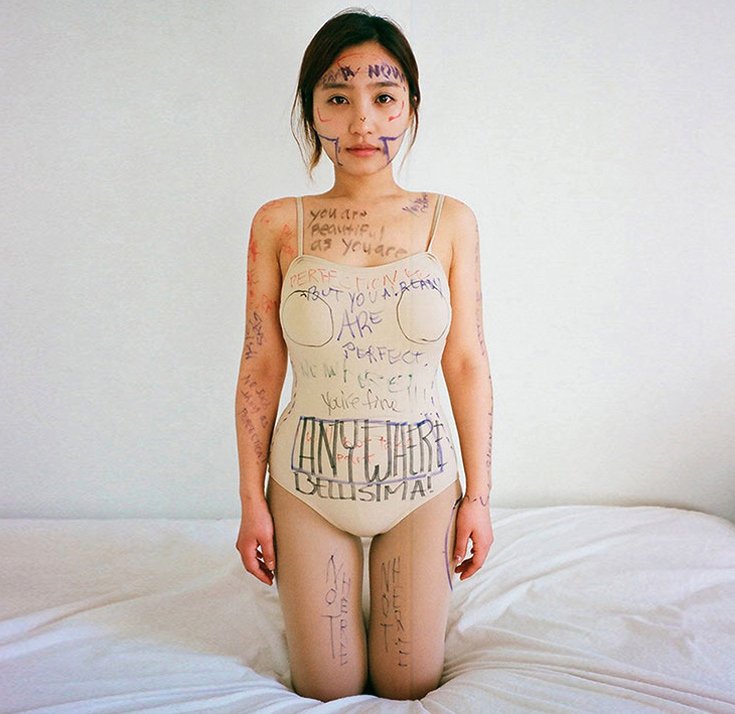 «Ζουμ» στις αίθουσες ανάρρωσης – Πώς είναι οι γυναίκες μετά από τις αισθητικές επεμβάσεις [εικόνες]  | iefimerida.gr 3