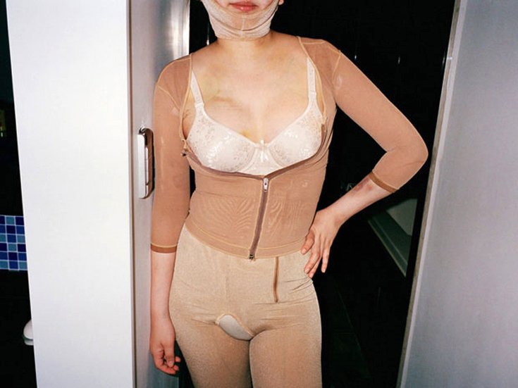 «Ζουμ» στις αίθουσες ανάρρωσης – Πώς είναι οι γυναίκες μετά από τις αισθητικές επεμβάσεις [εικόνες]  | iefimerida.gr 1