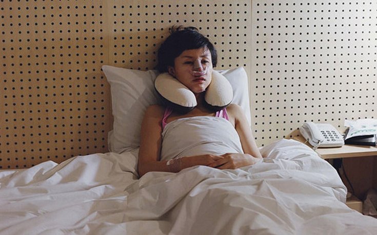 «Ζουμ» στις αίθουσες ανάρρωσης – Πώς είναι οι γυναίκες μετά από τις αισθητικές επεμβάσεις [εικόνες]  | iefimerida.gr 2