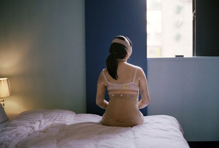 «Ζουμ» στις αίθουσες ανάρρωσης – Πώς είναι οι γυναίκες μετά από τις αισθητικές επεμβάσεις [εικόνες]  | iefimerida.gr 7