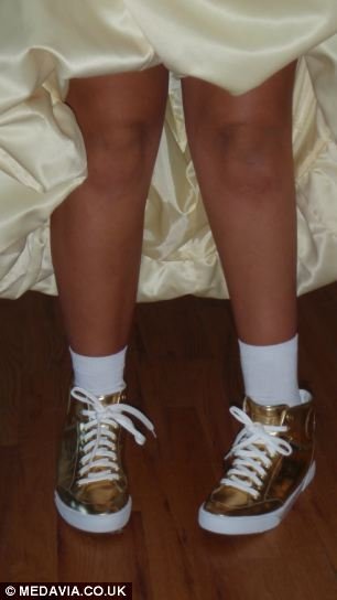 21χρονη έκοψε το πόδι της για να φοράει ψηλά τακούνια [εικόνες] | iefimerida.gr 5